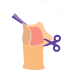 Circumcision