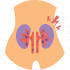 Kidney Stone