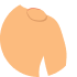 Lipoma Removal