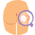 Pilonidal Sinus