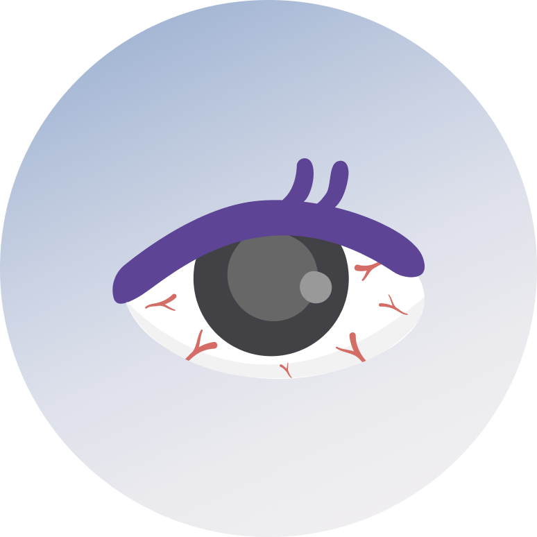 Eye Infections