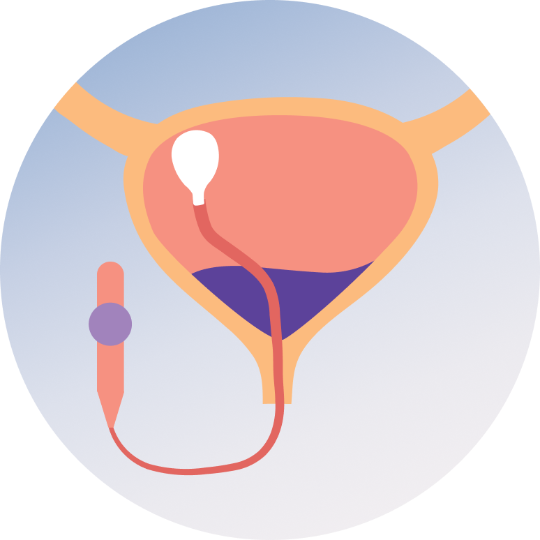 Urological Procedure(Cystoscopy & Open Surgery)