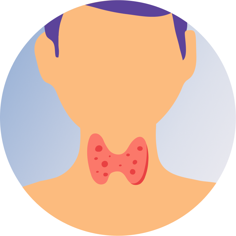 Thyroid Cancer