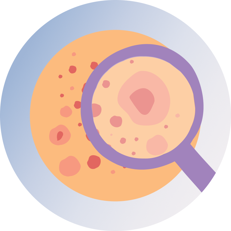 Fungal Skin Infection Treatment