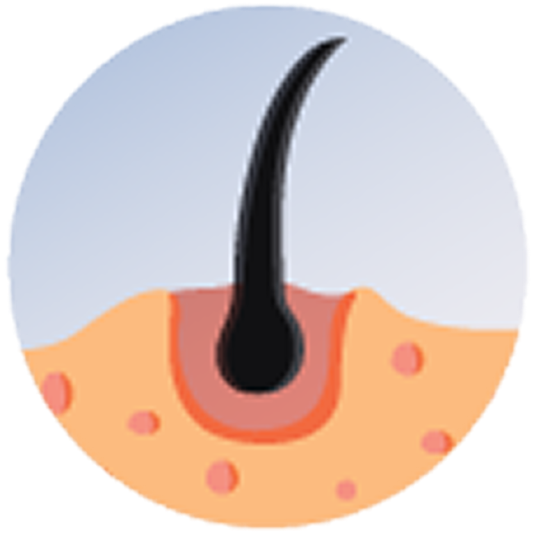 Hair Loss Treatment