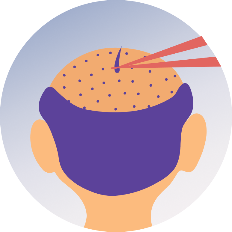 Hair Transplant Surgery