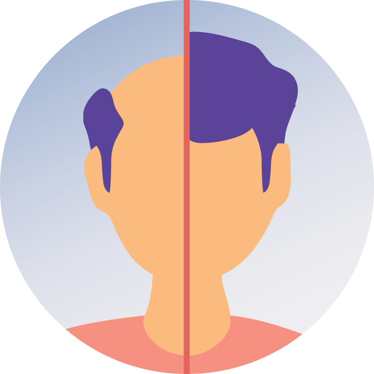 Hair Regrowth