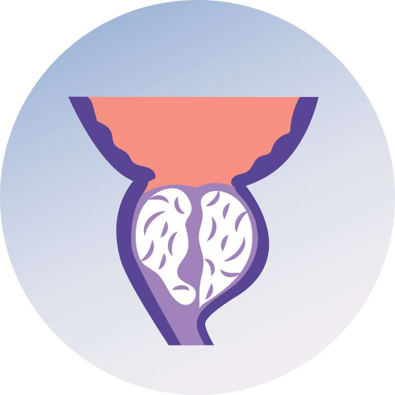 Prostate Laser Surgery