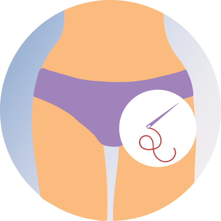 Hymenoplasty