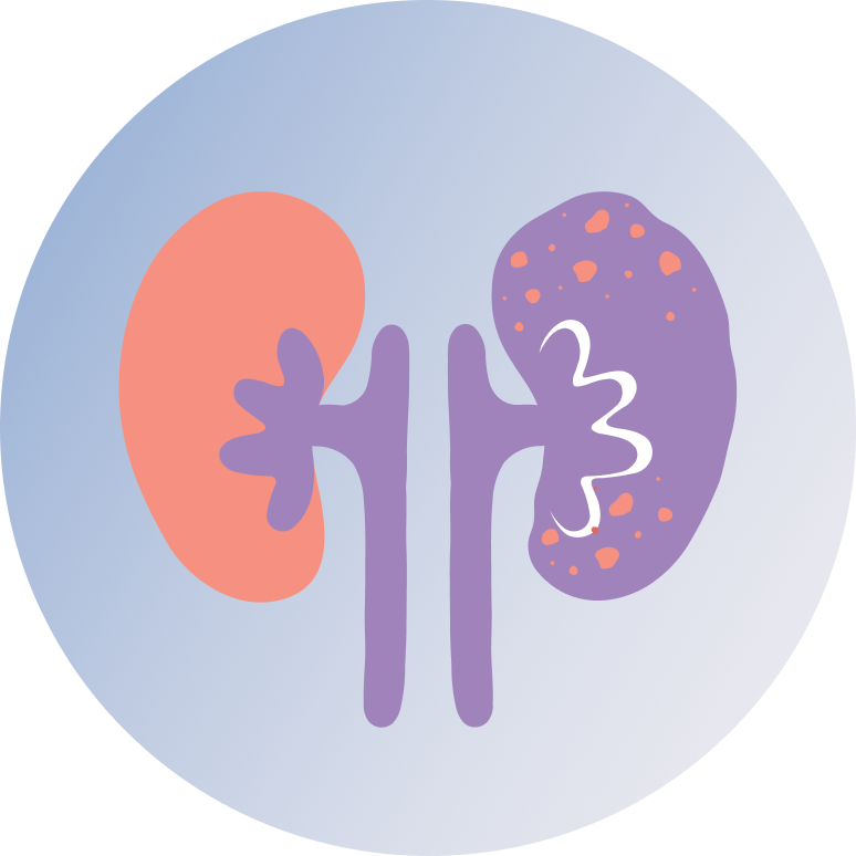 Acute Renal Failure