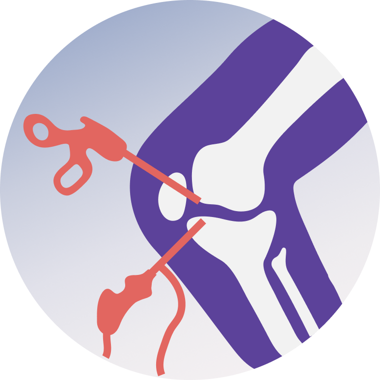 ACL &PCL Reconstruction