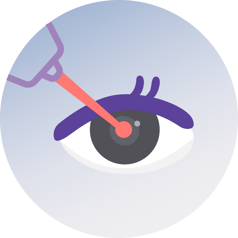 LASIK Surgery