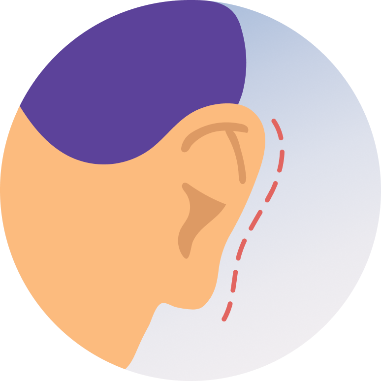 Ear Tube Placement