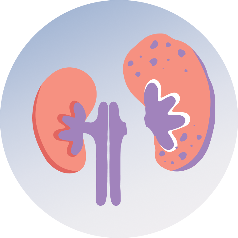 robotic partial nephrectomy