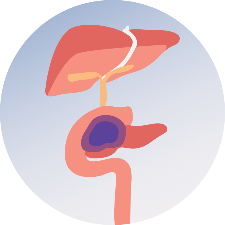 Whipple's Disease