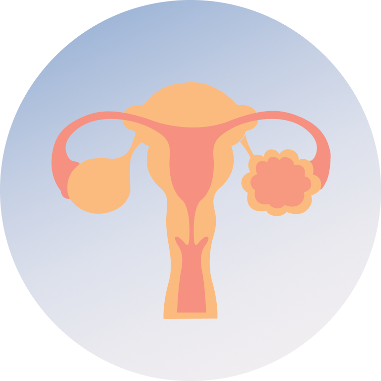 PCOS