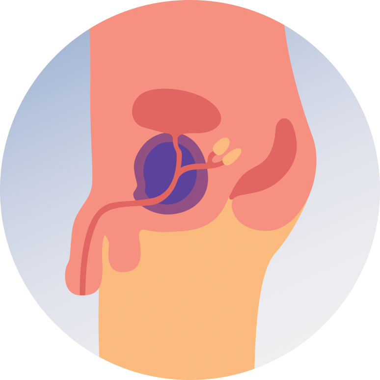 Prostate Cancer