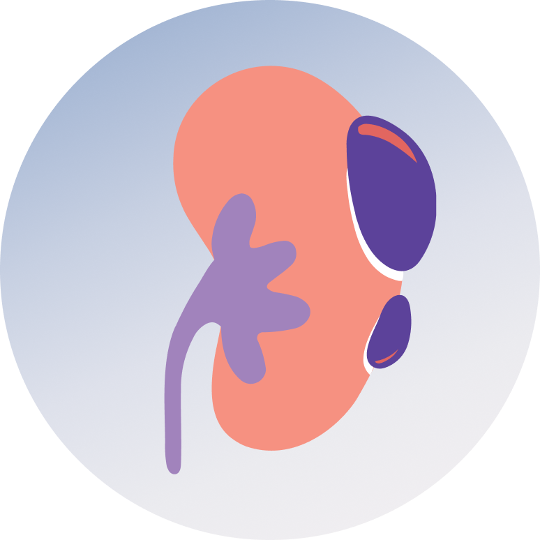 Homeopathic Treatment for Kidney Cyst