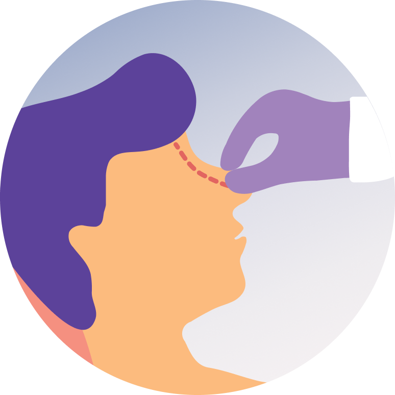 Nasal Septum Surgery (SEPTOPLASTY)