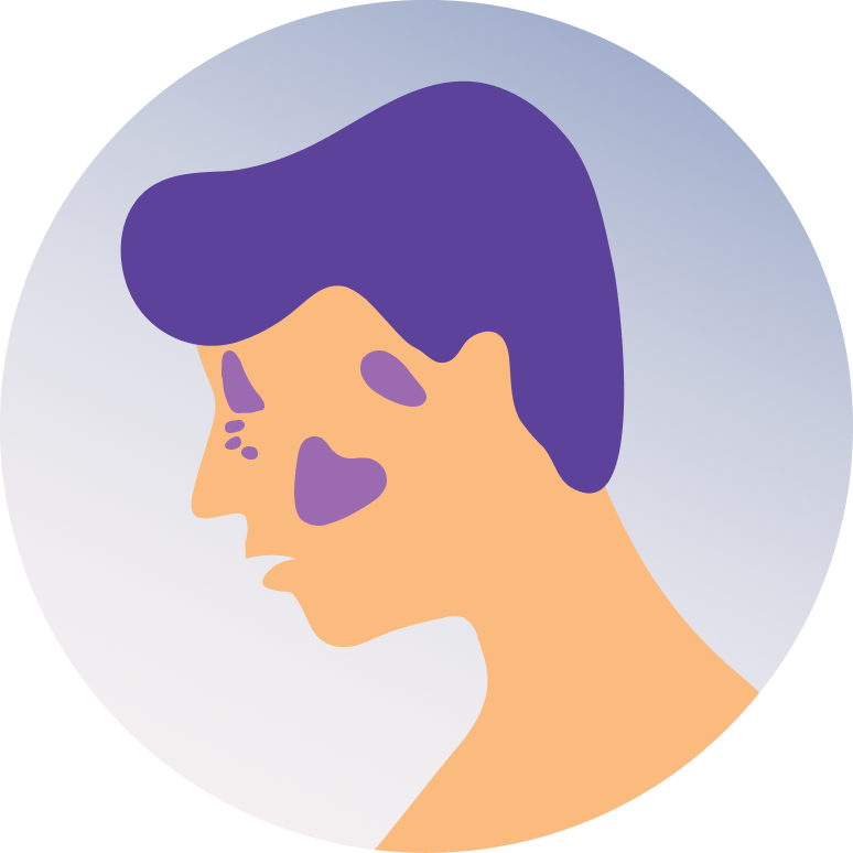 Acute Sinusitis