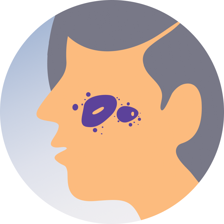 Skin Cancer Care