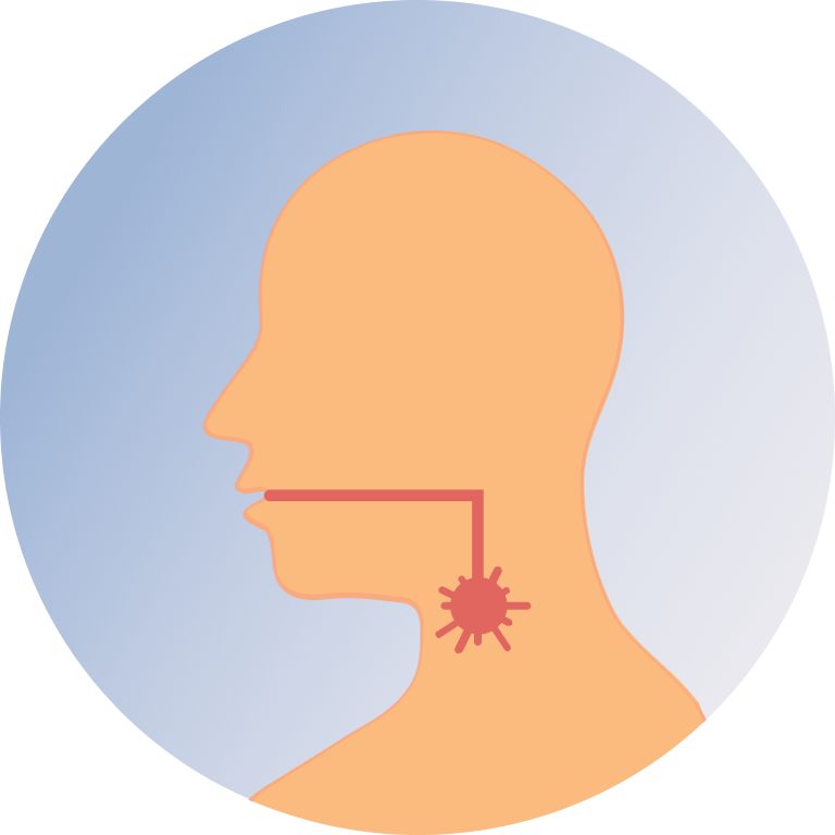 Throat Pain