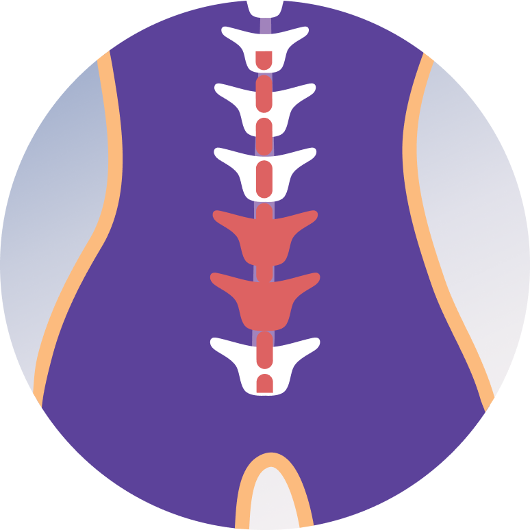 Kyphoplasty