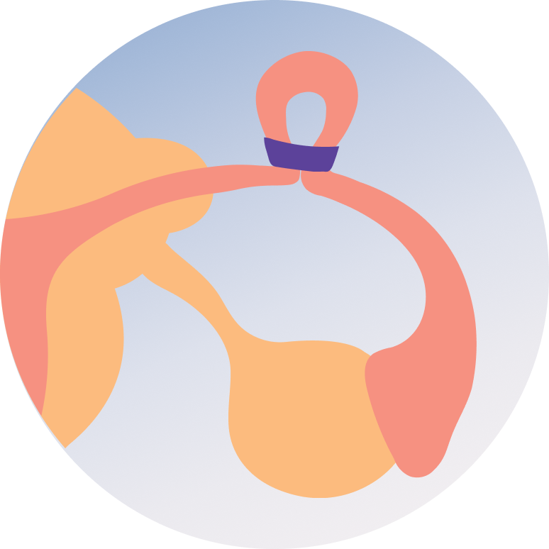 Tubal Ligation