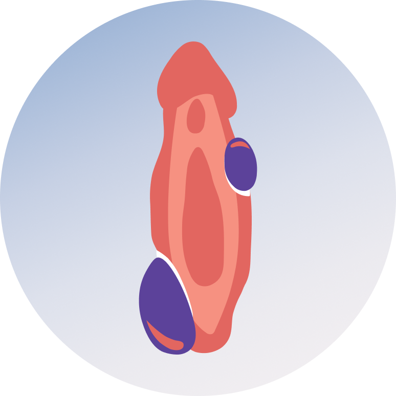 Vaginal Cyst Treatment