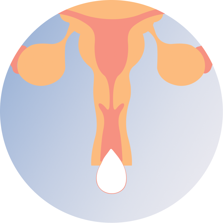 Yeast Infections