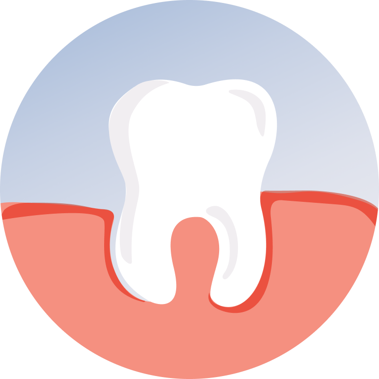 Teeth Reshaping