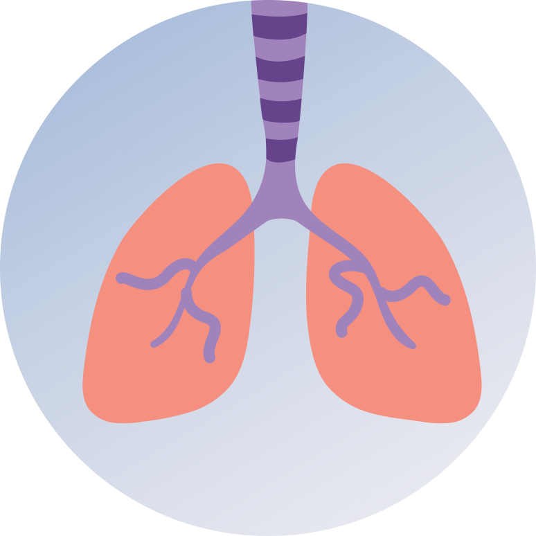 Pleural Effusion