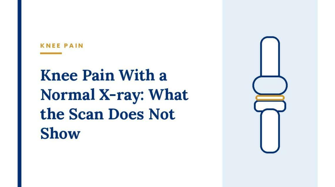 Knee Pain With a Normal X-Ray: What the Scan Does Not Show