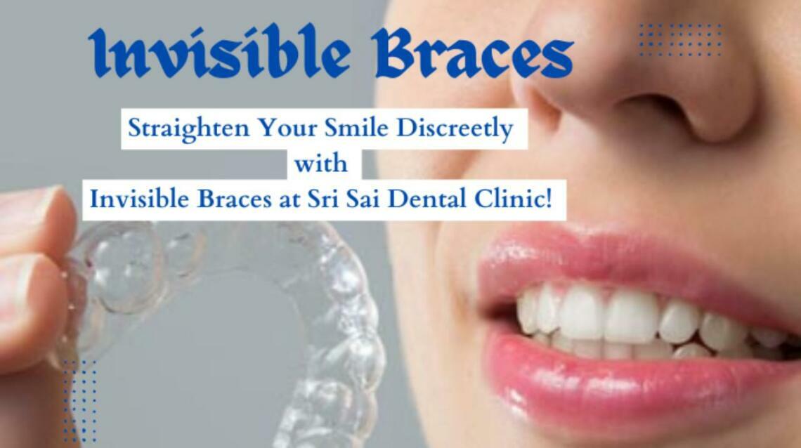 Invisalign: The Clear Path to a Perfect Smile