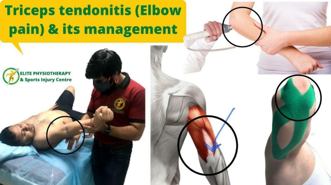 Triceps Tendonitis (Elbow Pain) & Its Management