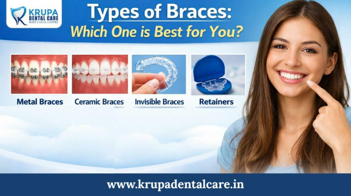 Types of Braces: Which One Is Best for You? | Krupa Dental Care |