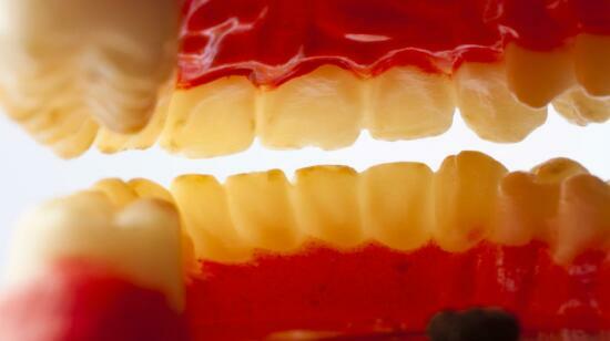 Are Your Gums Trying to Tell You Something?truth About Bleeding Gums That No One Talks About!