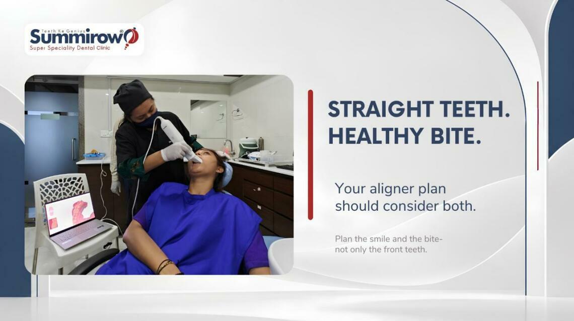 Straight Teeth or a Healthy Bite: What Should Aligners Correct?