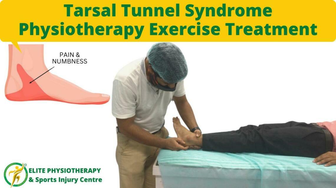 Tarsal Tunnel Syndrome Physiotherapy Exercise Treatment