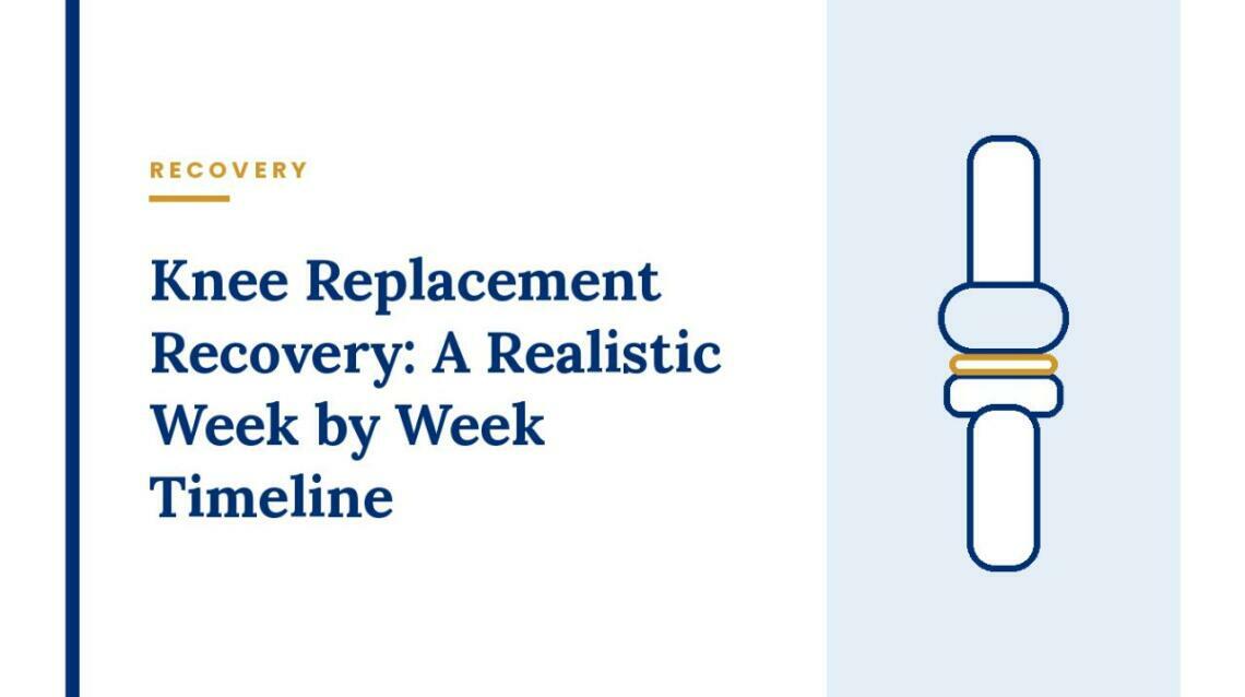 Knee Replacement Recovery: A Realistic Week by Week Timeline