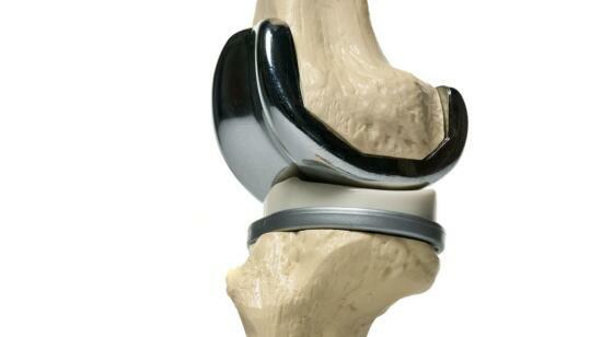Total Knee Replacement in Mumbai: When Is the Right Time to Stop Living With Knee Pain?