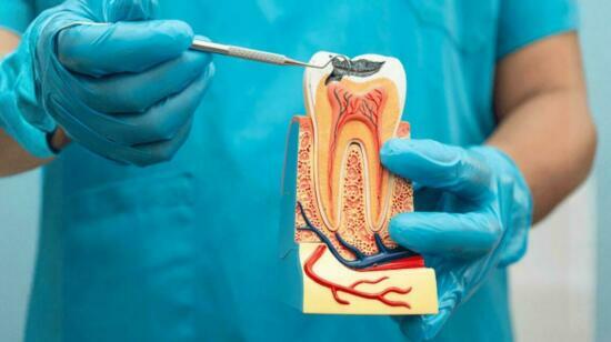 What Is Root Canal Treatment? Symptoms, Procedure & Recovery