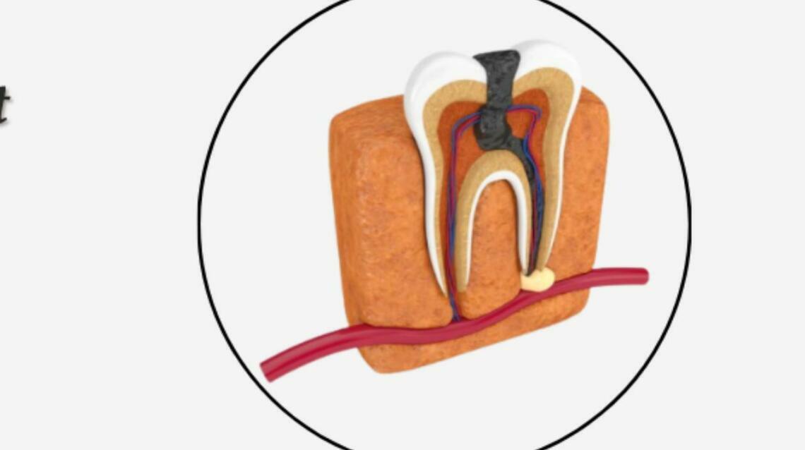 Should Root Canal Treatment (Pulpotomy/ Pulpectomy) Be Done for Children?