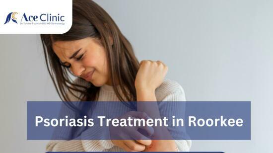 Best Doctor for Psoriasis Treatment in Roorkee