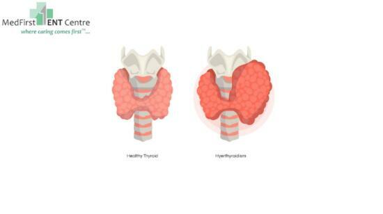 Surgery of the Thyroid Gland