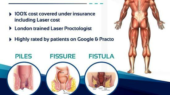 Piles/haemorrhoids - Laser Treatment and Laser Surgery