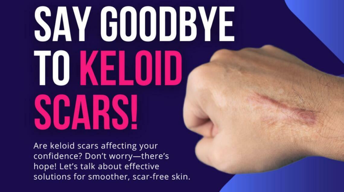 Naturally Flattening Keloid Scars