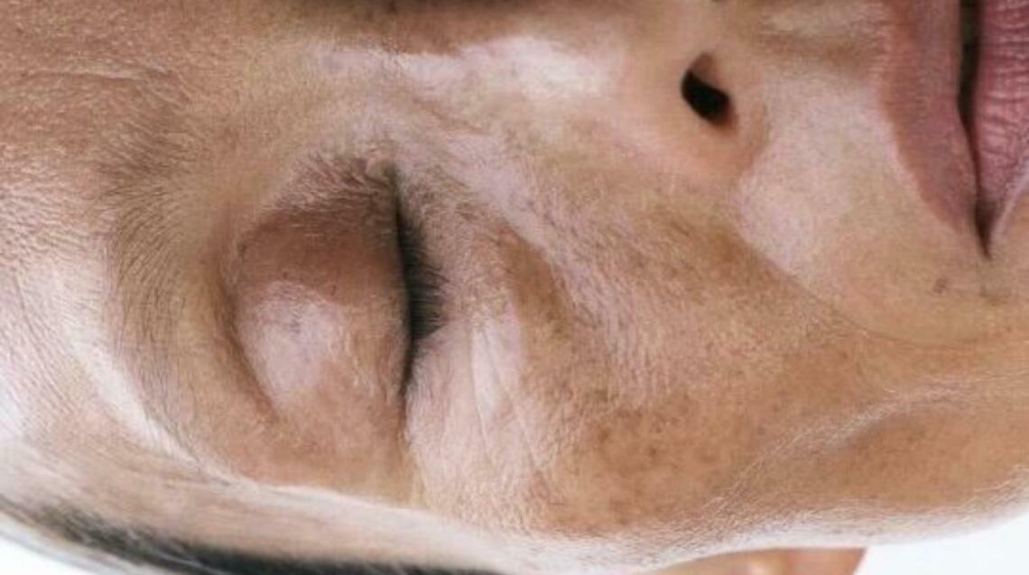 Top 7 Reasons Your Skin Pigmentation Keeps Coming Back (Even After Treatment)