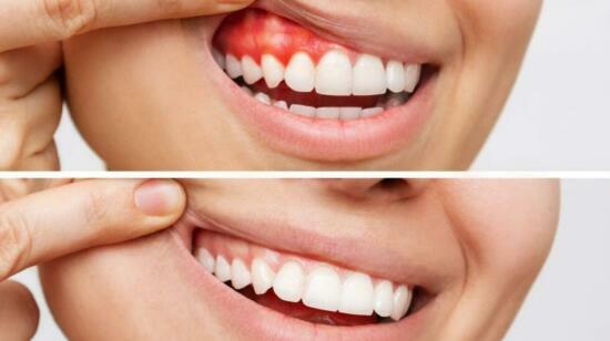 The Silent Hero: How Healthy Gums Protect Overall Health