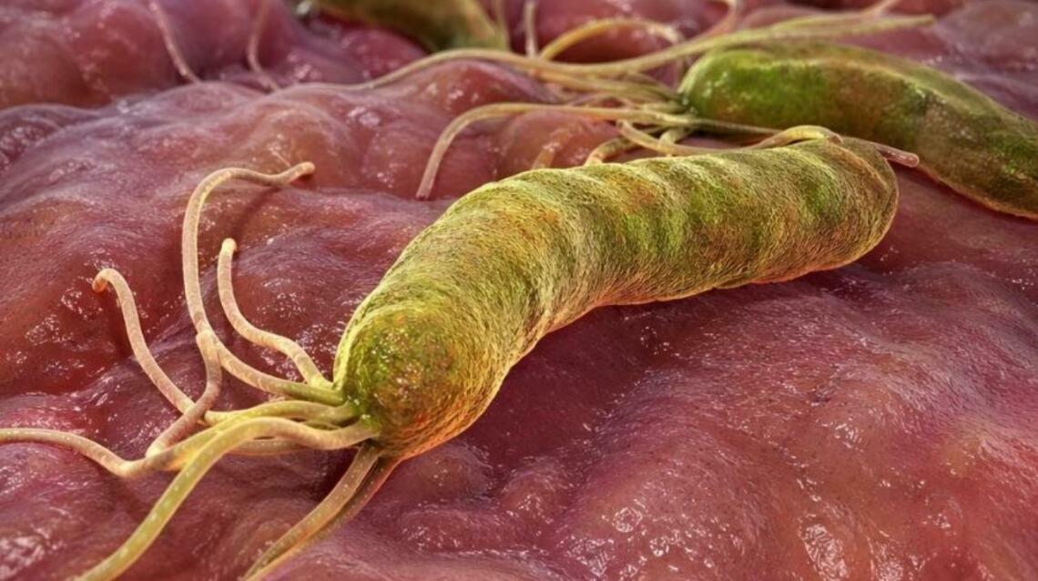 Why Your "Gas" Problem Isn't Just About Food: The Silent Role of H. Pylori